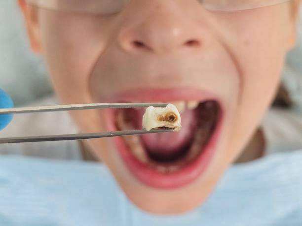 Best Emergency Treatment for Toothache in Ridgefield, NJ